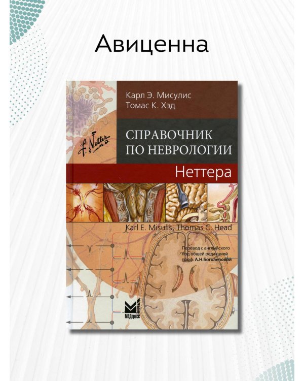 Справочник по неврологии Неттера