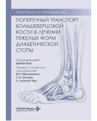 Поперечный транспорт большеберцовой кости в лечении тяжелых форм диабетической стопы. Практическое руководство