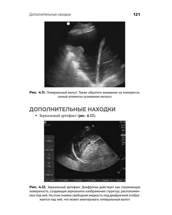 Ультразвуковое исследование при экстренных и неотложных состояниях. Карманный атлас-справочник