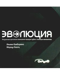 Эволюция. Актуальные протоколы замещения передних зубов с помощью имплантатов