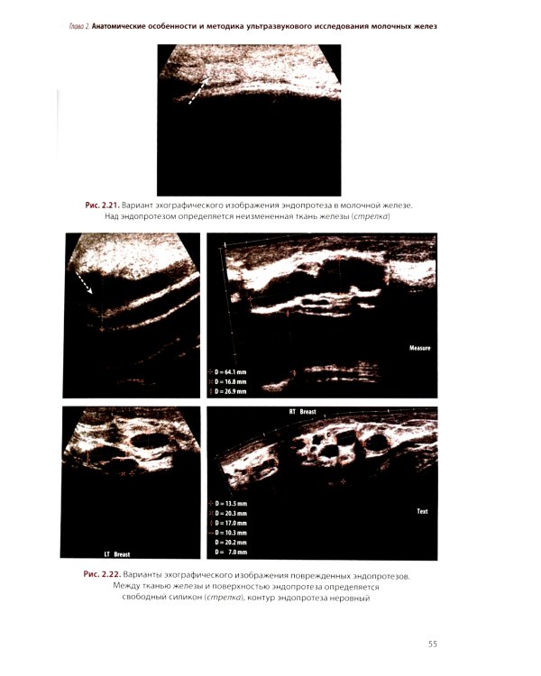 УЗИ в маммологии: руководство для врачей