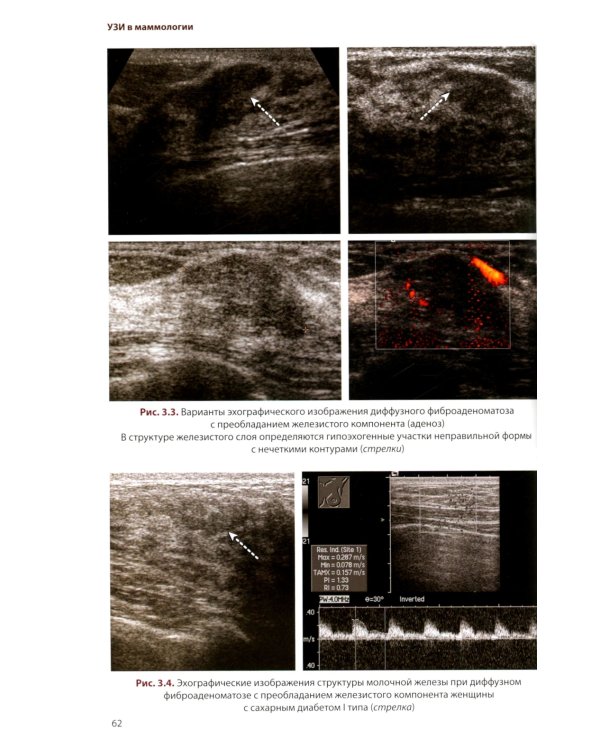 УЗИ в маммологии: руководство для врачей