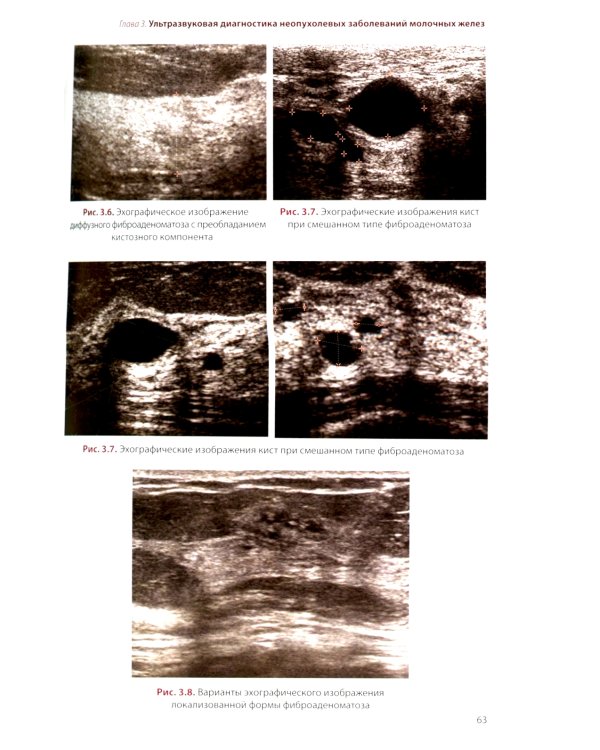 УЗИ в маммологии: руководство для врачей