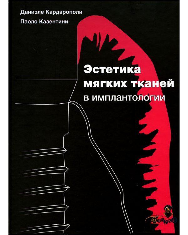 Эстетика мягких тканей в имплантологии