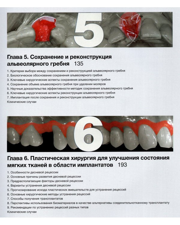 Эстетика мягких тканей в имплантологии