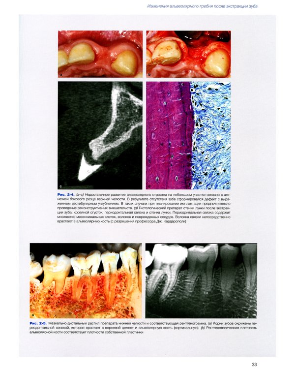 Эстетика мягких тканей в имплантологии