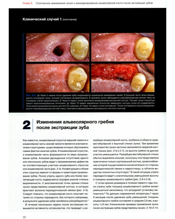 Эстетика мягких тканей в имплантологии