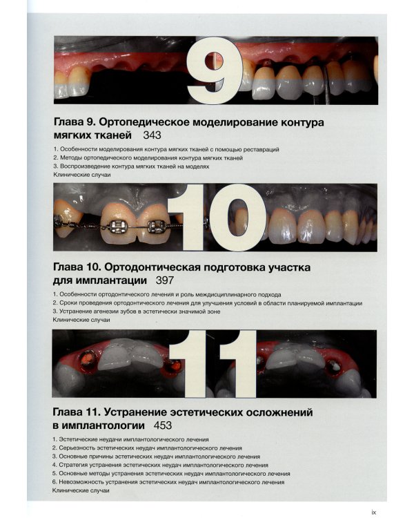 Эстетика мягких тканей в имплантологии