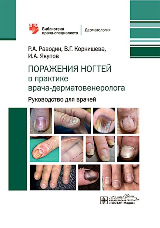 Библиотека врача-специалиста Поражения ногтей в практике врача-дерматовенеролога: руководство для врачей