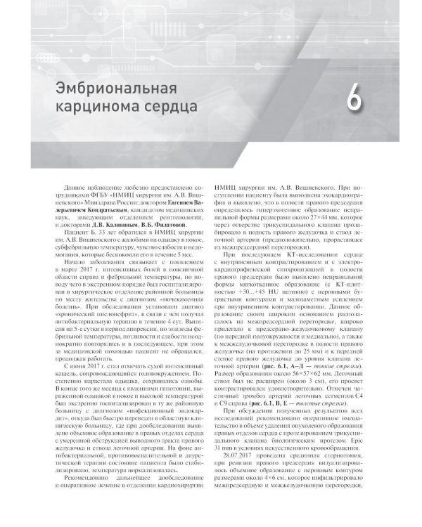 Распознавание новообразований торакоабдоминальной локализации: 100 сложных и необычных наблюдений