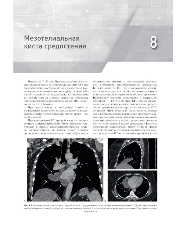 Распознавание новообразований торакоабдоминальной локализации: 100 сложных и необычных наблюдений