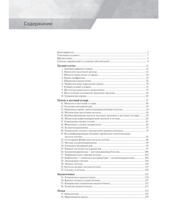 Распознавание новообразований торакоабдоминальной локализации: 100 сложных и необычных наблюдений