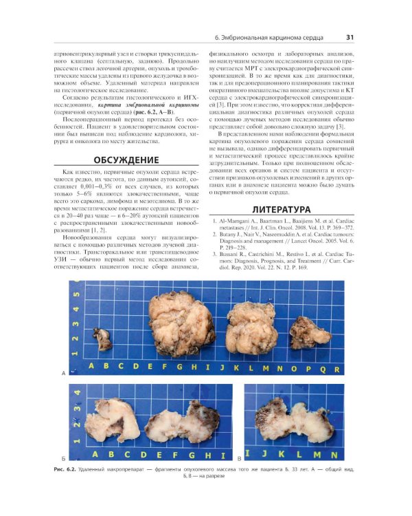 Распознавание новообразований торакоабдоминальной локализации: 100 сложных и необычных наблюдений
