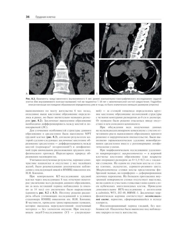 Распознавание новообразований торакоабдоминальной локализации: 100 сложных и необычных наблюдений