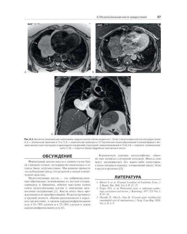 Распознавание новообразований торакоабдоминальной локализации: 100 сложных и необычных наблюдений