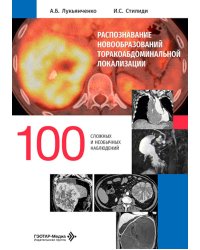 Распознавание новообразований торакоабдоминальной локализации: 100 сложных и необычных наблюдений