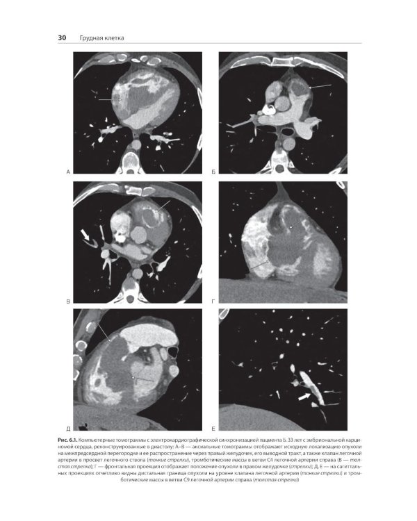 Распознавание новообразований торакоабдоминальной локализации: 100 сложных и необычных наблюдений