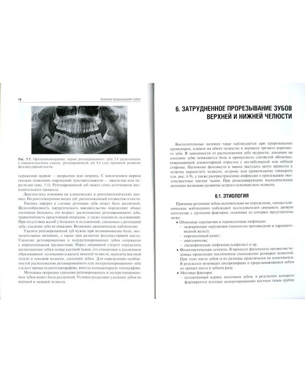 Болезни прорезывания зубов: Учебное пособие