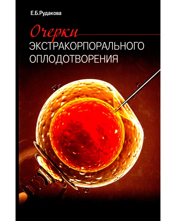 Очерки экстракорпорального оплодотворения