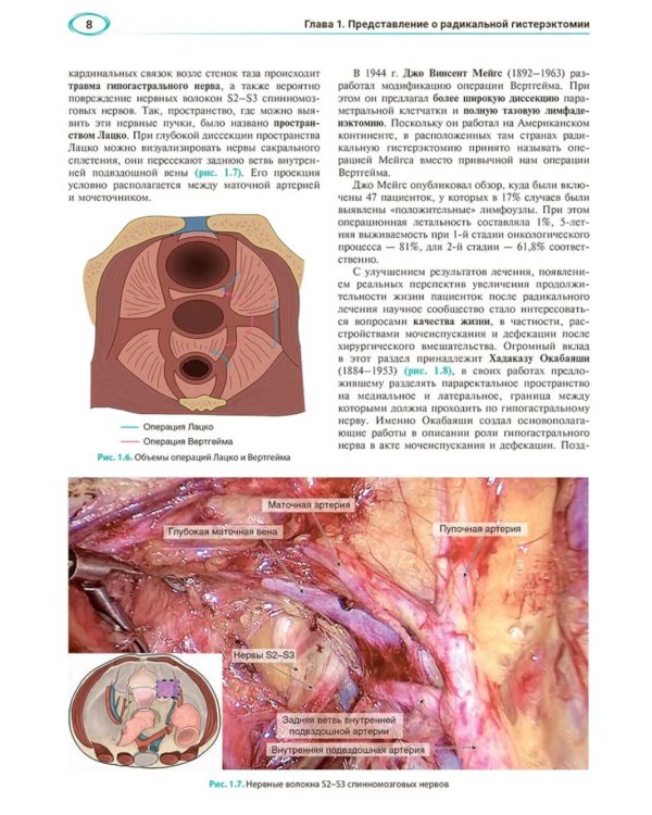 Атлас видеоэндоскопических операций в онкогинекологии