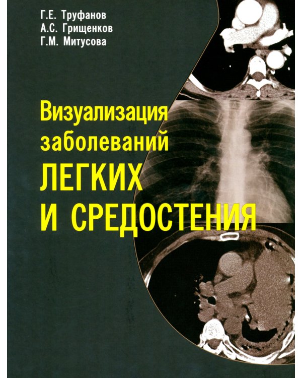 Визуализация заболеваний легких и средостения