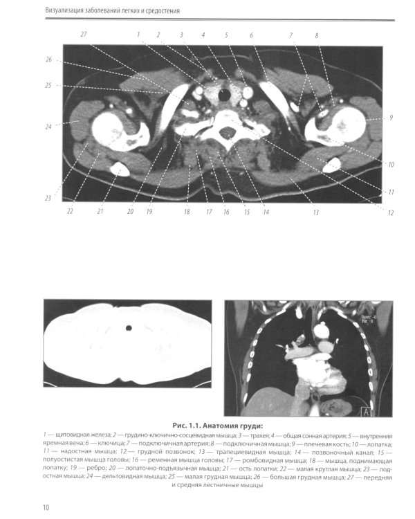 Визуализация заболеваний легких и средостения