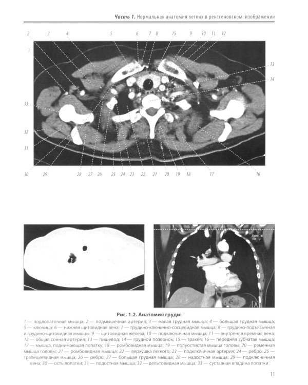 Визуализация заболеваний легких и средостения