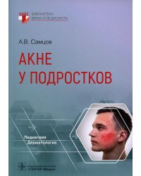 Акне у подростков
