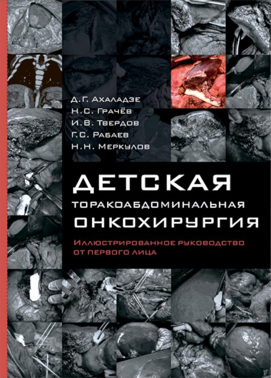 Детская торакоабдоминальная онкохирургия. Иллюстрированное руководство от первого лица Детская торакоабдоминальная онкохирургия. Иллюстрированное руководство от первого лица