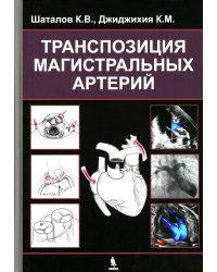 Транспозиция магистральных артерий