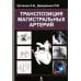 Транспозиция магистральных артерий