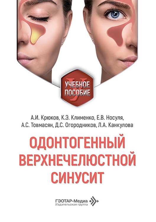 Одонтогенный верхнечелюстной синусит : учебное пособие