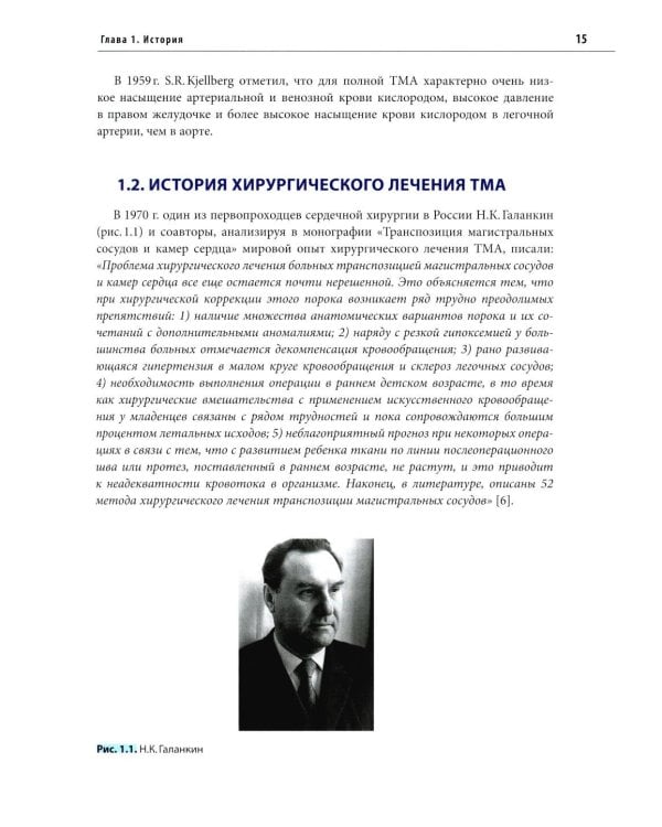 Транспозиция магистральных артерий