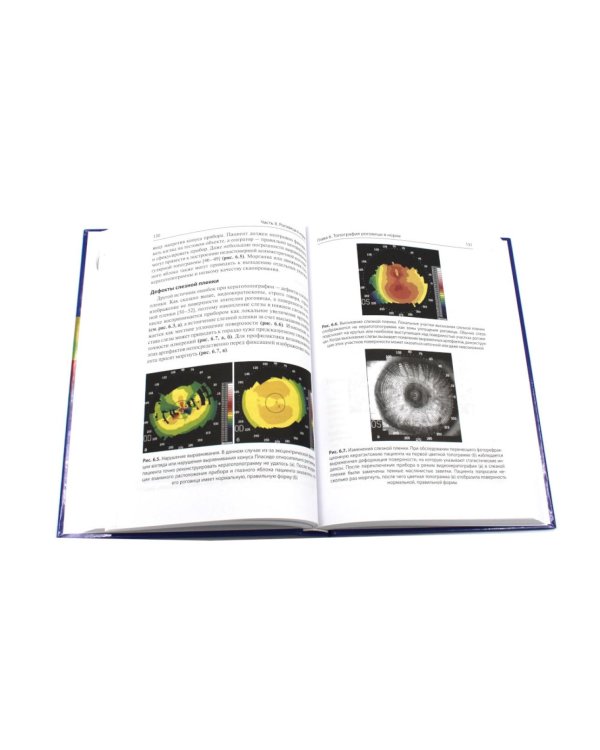 Кератотопография. Теория и практика