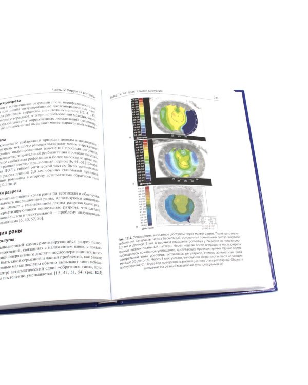 Кератотопография. Теория и практика