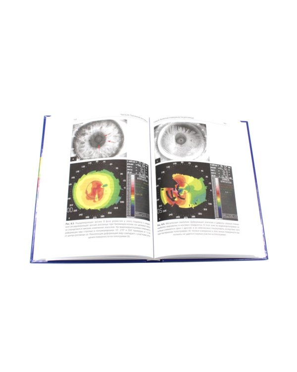 Кератотопография. Теория и практика