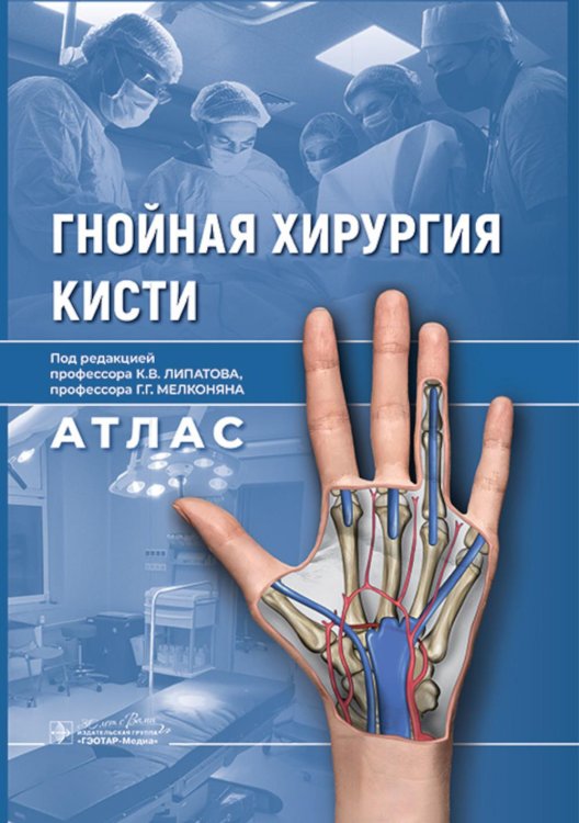 Гнойная хирургия кисти. Атлас Гнойная хирургия кисти. Атлас