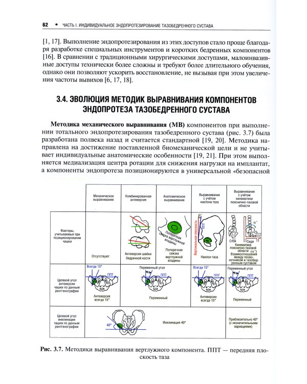 Индивидуальное эндопротезирование тазобедренного и коленного суставов