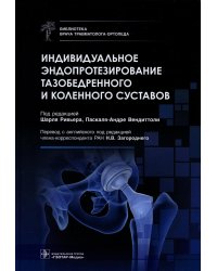 Индивидуальное эндопротезирование тазобедренного и коленного суставов