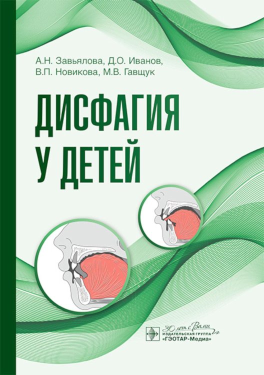 Дисфагия у детей