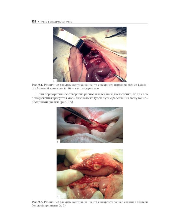 Хирургические болезни недоношенных детей: национальное руководство