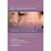 Акне и розацеа. Клинические проявления, диагностика и лечение: руководство для врачей. 2-е изд., перераб. и доп