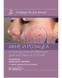 Акне и розацеа. Клинические проявления, диагностика и лечение: руководство для врачей. 2-е изд., перераб. и доп