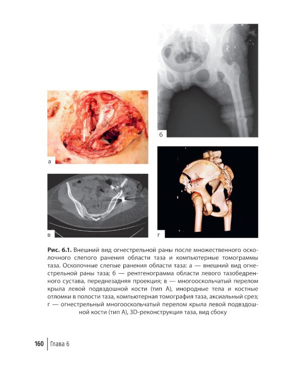 Огнестрельные ранения груди, живота, таза и позвоночника: руководство для врачей. 2-е изд., перераб. и доп
