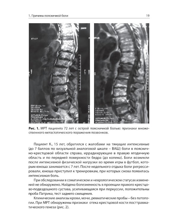Боли в поясничной области