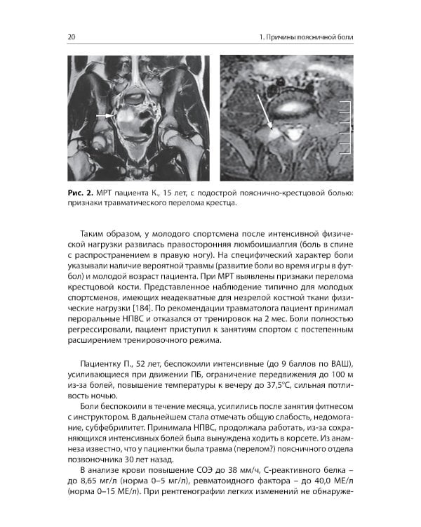 Боли в поясничной области