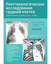 Рентгенологическое исследование грудной клетки. Практическое руководство. Атлас. 2-е изд., перераб.и доп