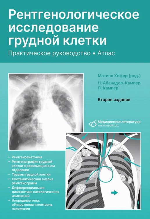 Рентгенологическое исследование грудной клетки. Практическое руководство. Атлас. 2-е изд., перераб.и доп Рентгенологическое исследование грудной клетки. Практическое руководство. Атлас. 2-е изд., перераб.и доп