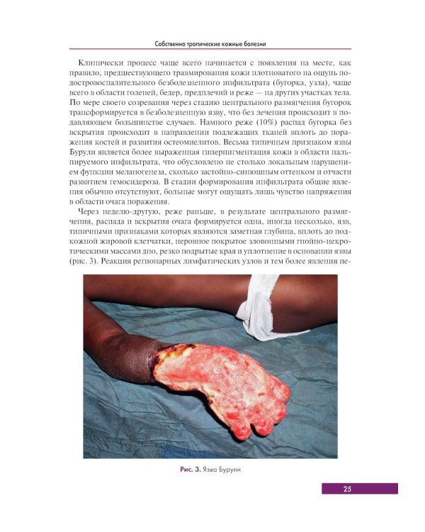 Тропическая дерматология