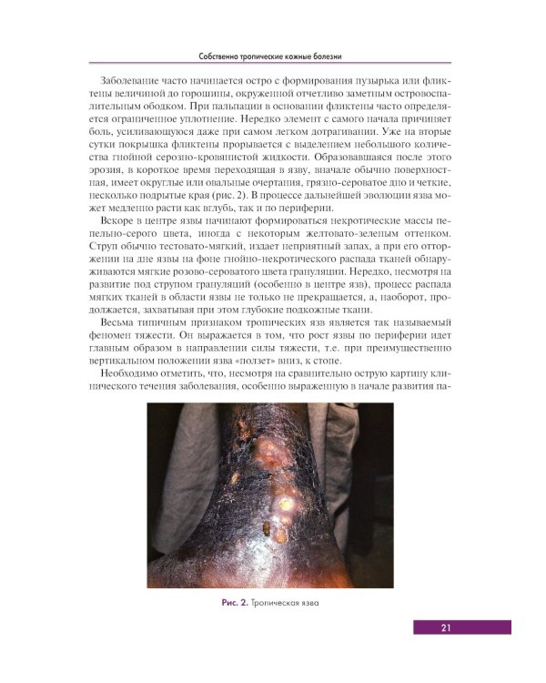 Тропическая дерматология